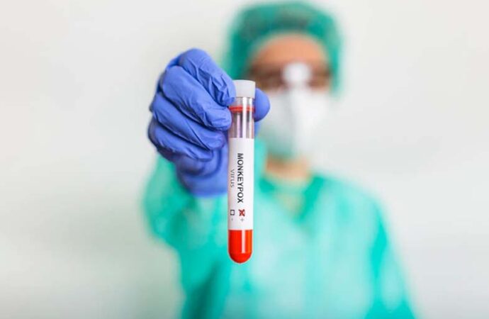 Fiocruz pede registro de dois testes para a varíola dos macacos
